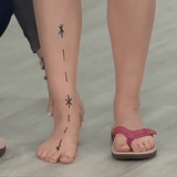 Wanda® | Orthopedic Summer Sandals For Ultimate Comfort